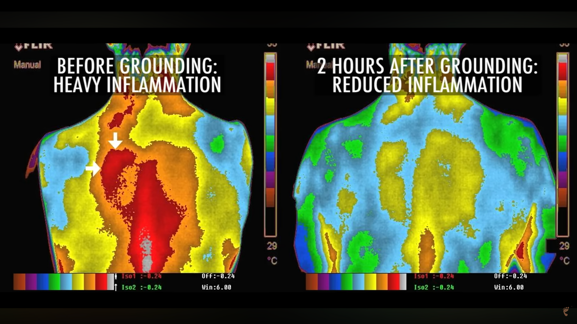 Thermal imaging example 1